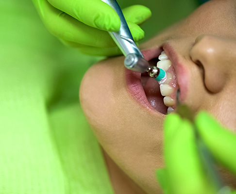 Woman having teeth polished