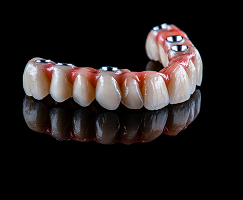 Model of dental bridges
