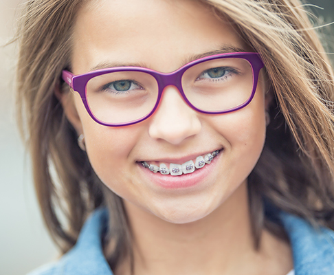 Orthdontics teeth with braces